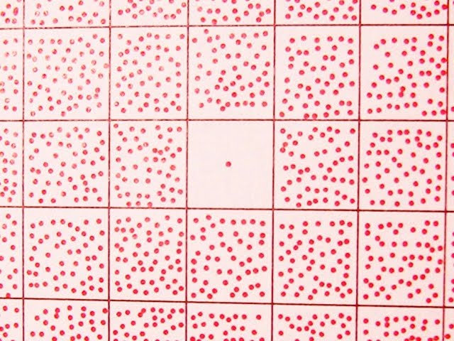 Crazy BABY Eyes … and More: IMG! #44